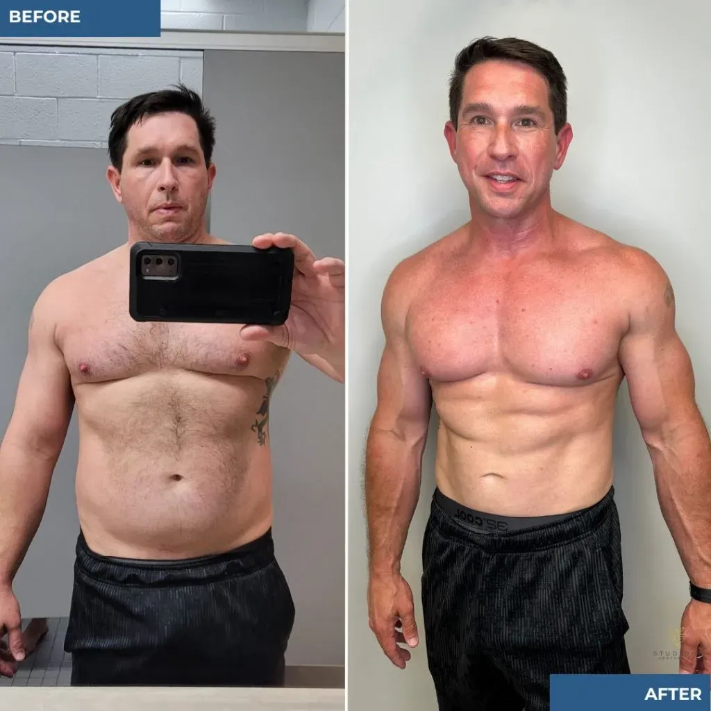 Weight Loss Before & After