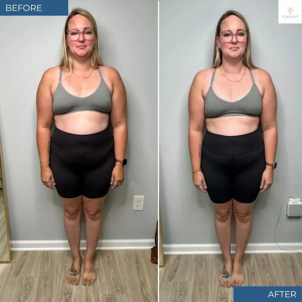 Weight Loss Before & After