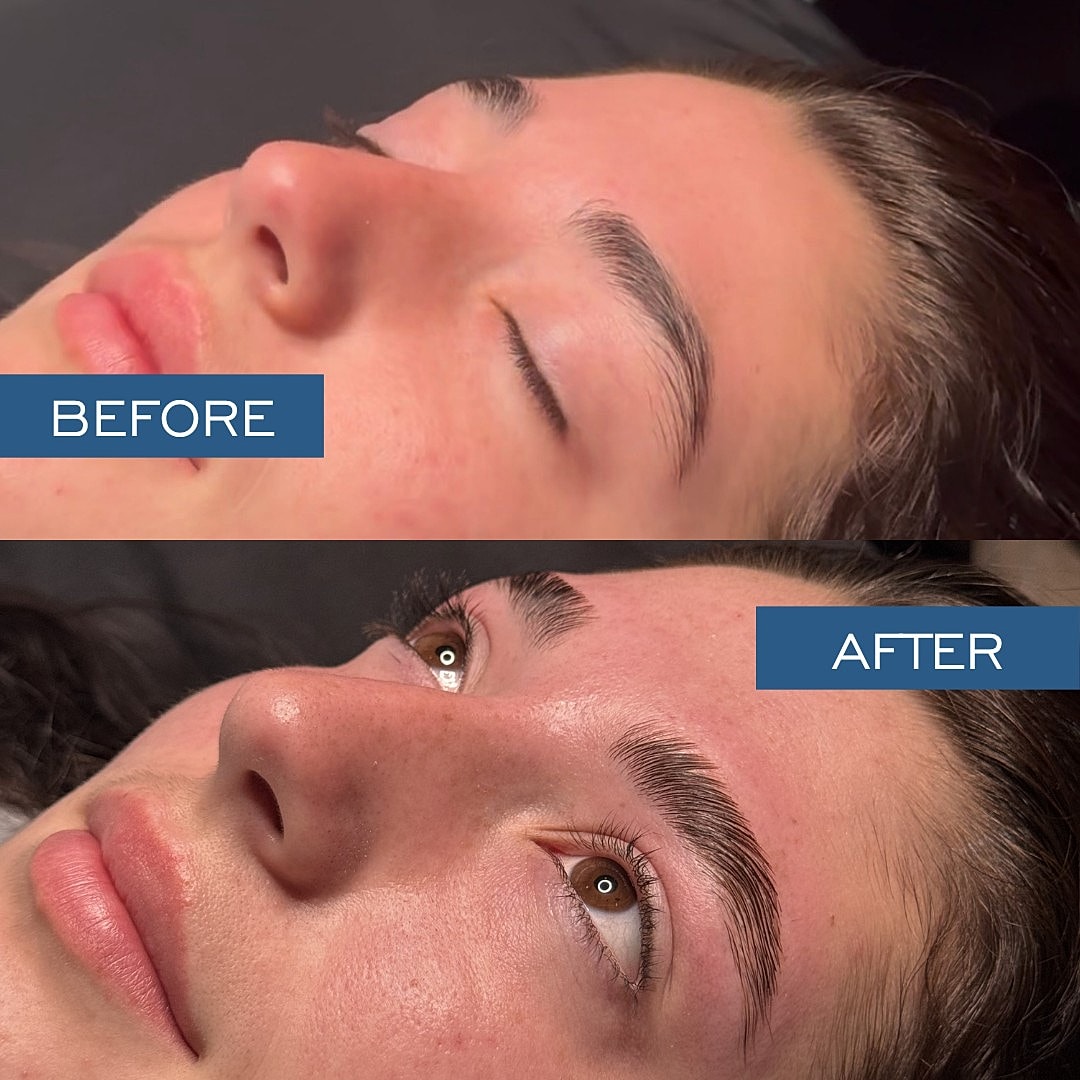 Brow Lamination Before & After