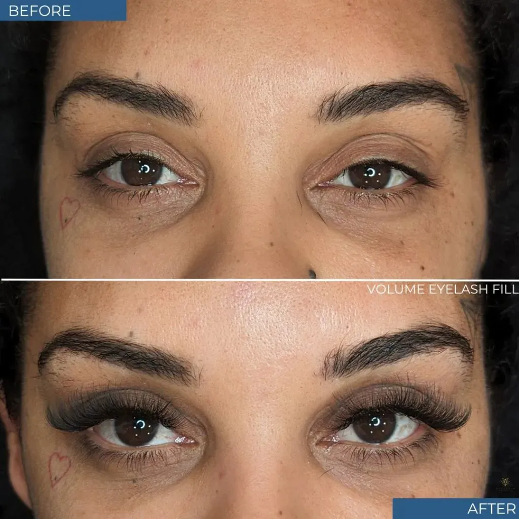 Esthetician Services Before & After