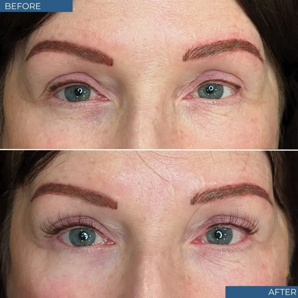 Esthetician Services Before & After