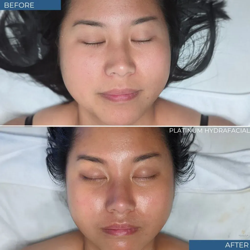 Esthetician Services Before & After