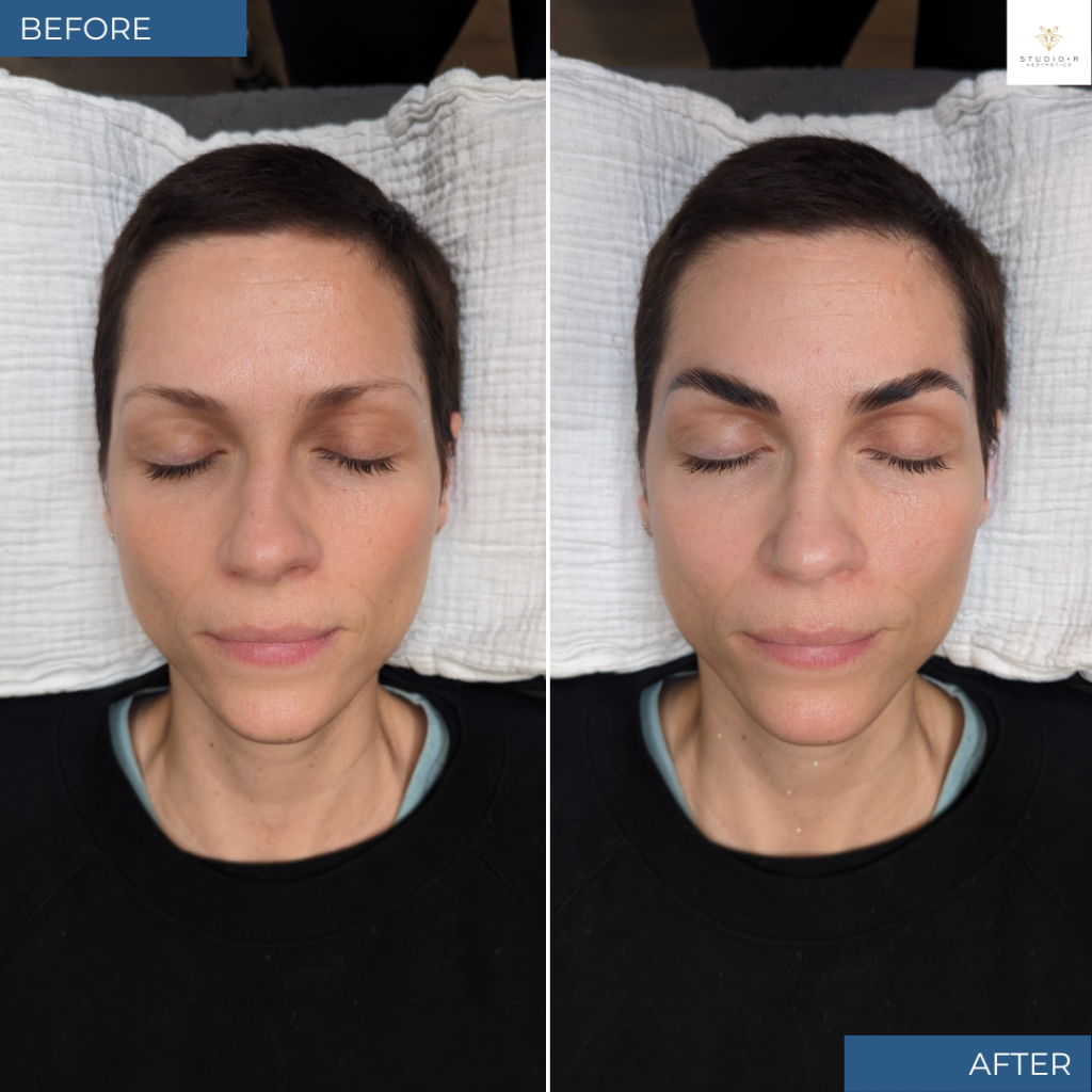 Esthetician Services Before & After